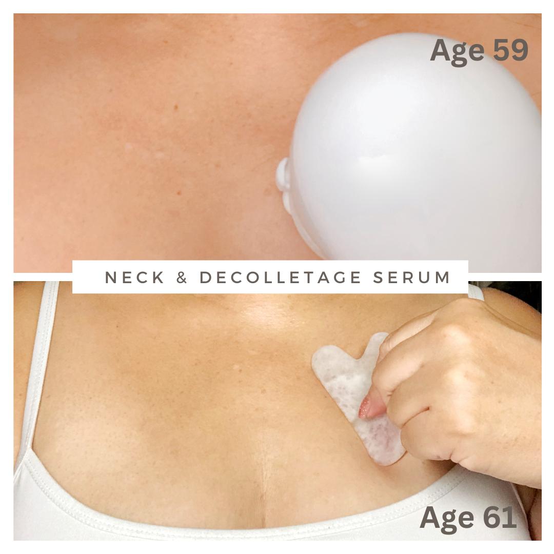 Neck & Décolletage Serum Reduce Sagging and Crepey Skin & Age Spots Pigmentation
