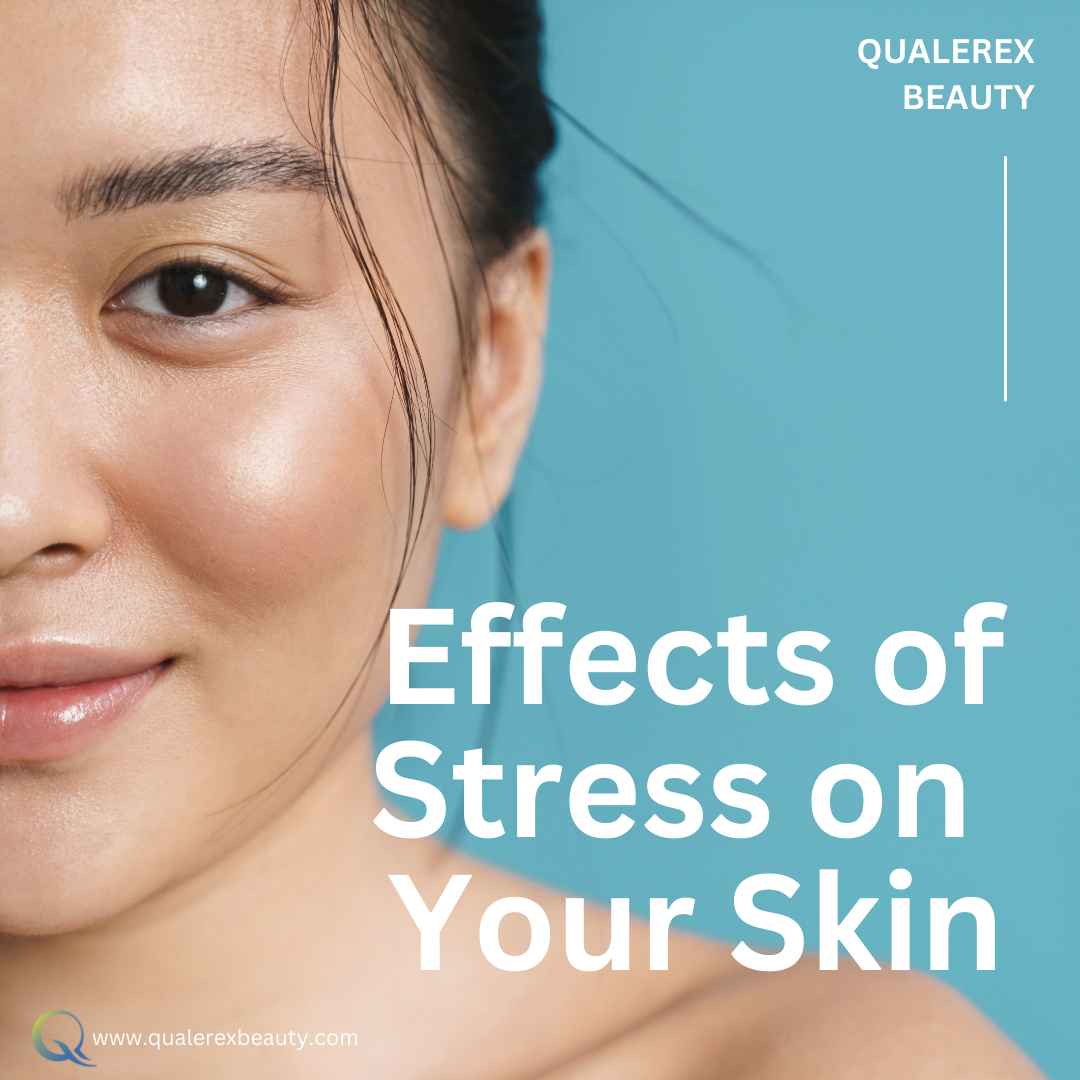 All About Stress And Its Effect On The Skin