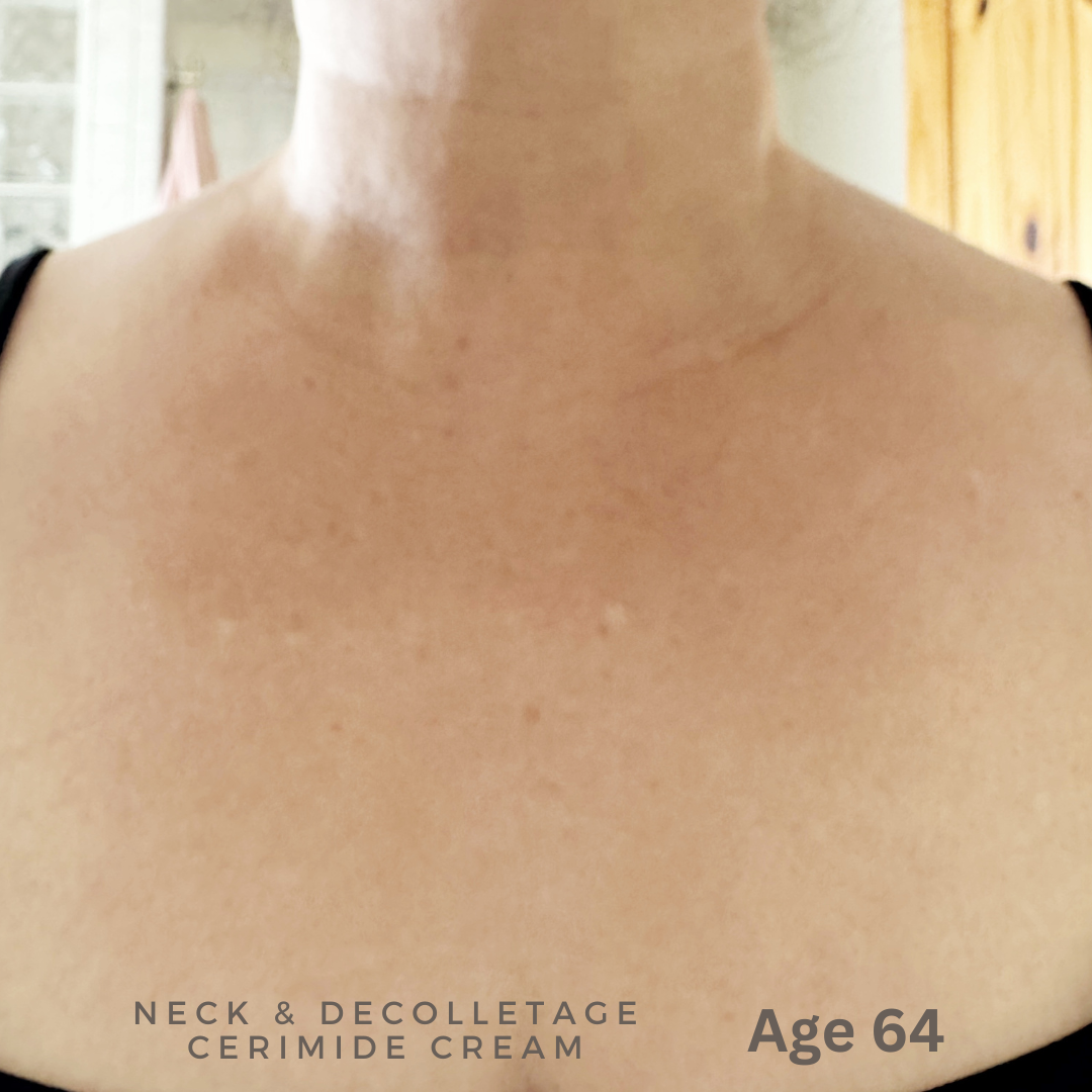 Neck & Décolletage Ceramide Cream for Mature & Menopausal Skin – Firming, Nourishing Botanical Formula